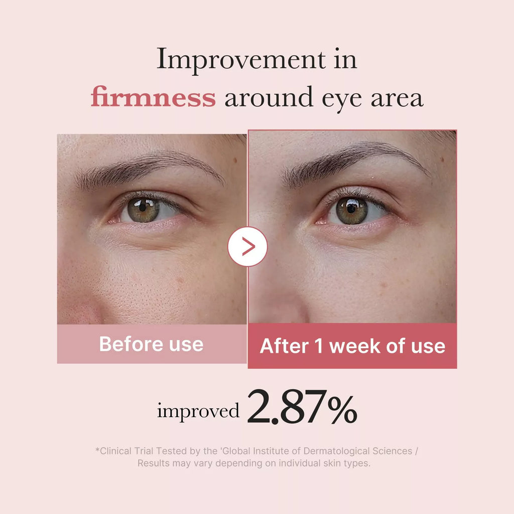 MEDICUBE PDRN PINK PEPTIDE EYE SERUM